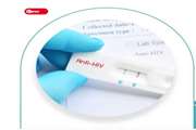 Peer interventions to improve HIV testing uptake among immigrants: A realist review